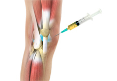 Orthobiologics for the Knee