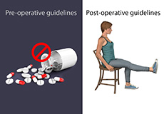 Pre-op and Post-op Knee Guidelines