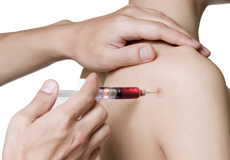 Platelet-Rich Plasma (PRP) Injection