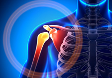 Shoulder Disorders